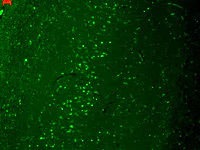 Immunohistochemistry (Formalin/PFA-fixed paraffin-embedded sections) - Anti-TRPV3 antibody [N15/4] (AB85022)