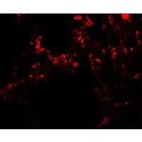 Immunocytochemistry/ Immunofluorescence - Anti-TRPV4 antibody (AB191580)