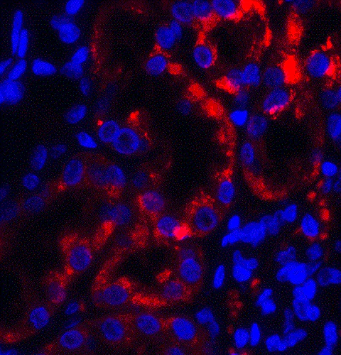 Immunocytochemistry/ Immunofluorescence - Anti-TRPV4 antibody (AB191580)