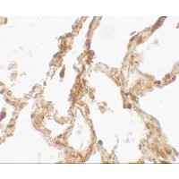 Immunohistochemistry (Formalin/PFA-fixed paraffin-embedded sections) - Anti-TRPV4 antibody (AB191580)