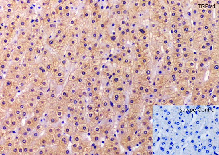 Immunohistochemistry (Formalin/PFA-fixed paraffin-embedded sections) - Anti-TRPV4 antibody (AB191580)