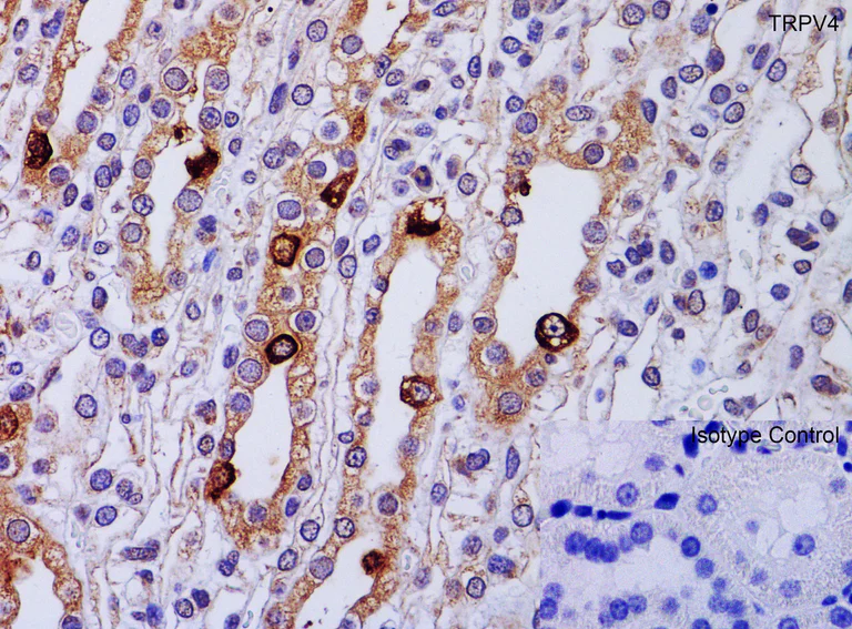 Immunohistochemistry (Formalin/PFA-fixed paraffin-embedded sections) - Anti-TRPV4 antibody (AB191580)