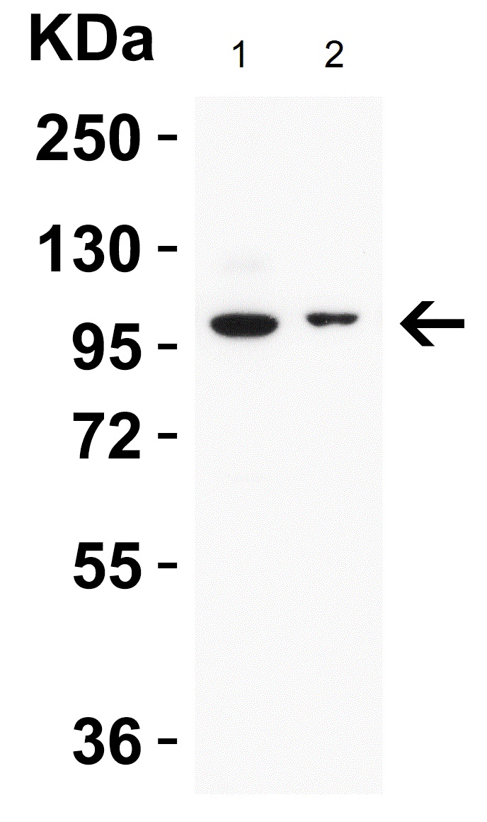 Anti-TRPV4 antibody