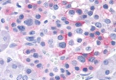Immunohistochemistry (Formalin/PFA-fixed paraffin-embedded sections) - Anti-TRPV4 antibody (AB219192), expandable thumbnail