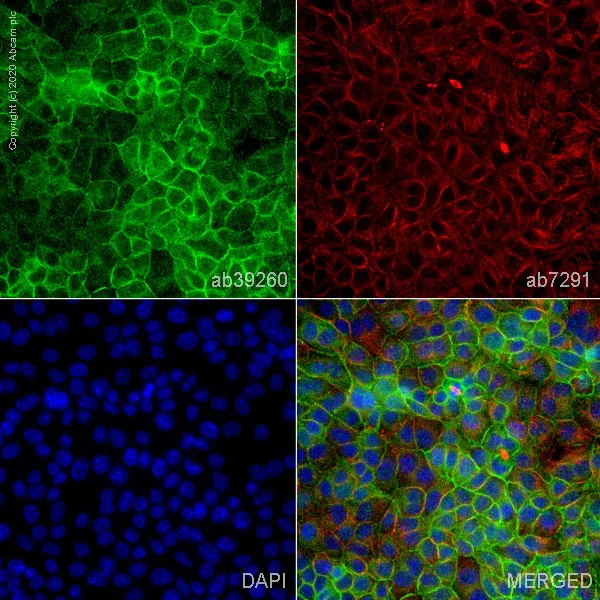 Immunocytochemistry/ Immunofluorescence - Anti-TRPV4 antibody (AB39260)