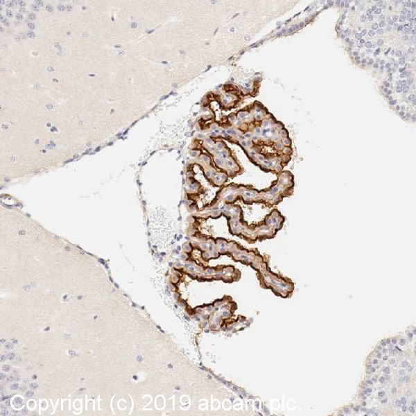 Immunohistochemistry (Formalin/PFA-fixed paraffin-embedded sections) - Anti-TRPV4 antibody (AB39260)