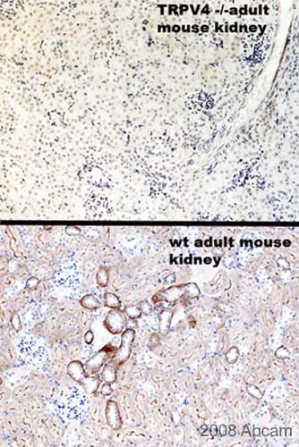 Immunohistochemistry (Formalin/PFA-fixed paraffin-embedded sections) - Anti-TRPV4 antibody (AB39260)