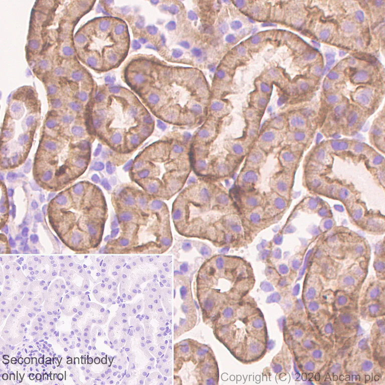 Immunohistochemistry (Formalin/PFA-fixed paraffin-embedded sections) - Anti-TRPV4 antibody [EPR23846-44] (AB259361)