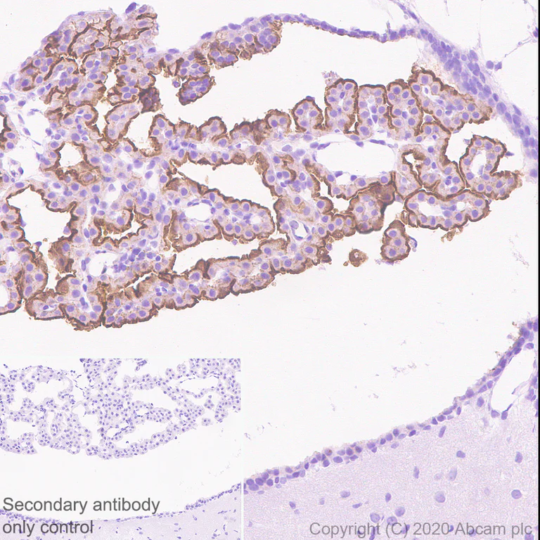 Immunohistochemistry (Formalin/PFA-fixed paraffin-embedded sections) - Anti-TRPV4 antibody [EPR23846-44] - BSA and Azide free (AB280365)
