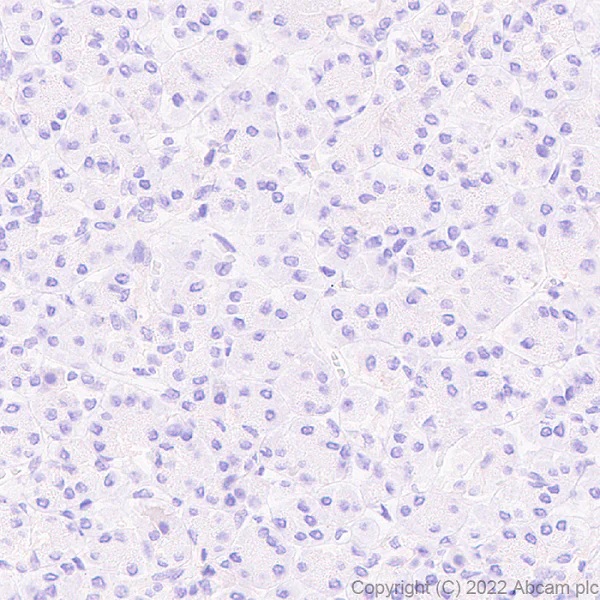 Immunohistochemistry (Formalin/PFA-fixed paraffin-embedded sections) - Anti-TRPV4 antibody [EPR27068-39] - BSA and Azide free (AB307445)
