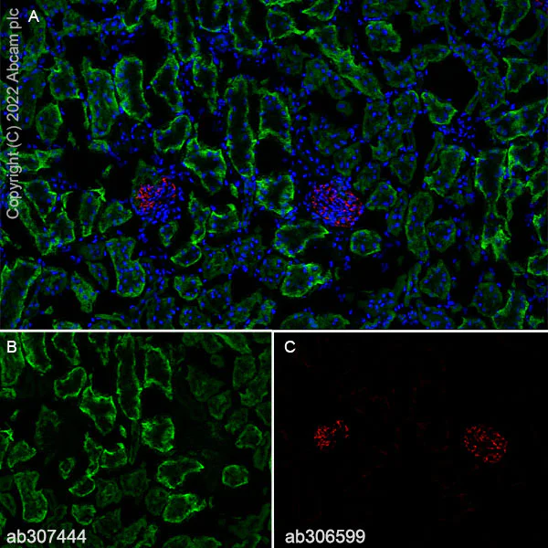 Immunohistochemistry (Frozen sections) - Anti-TRPV4 antibody [EPR27068-39] - BSA and Azide free (AB307445)