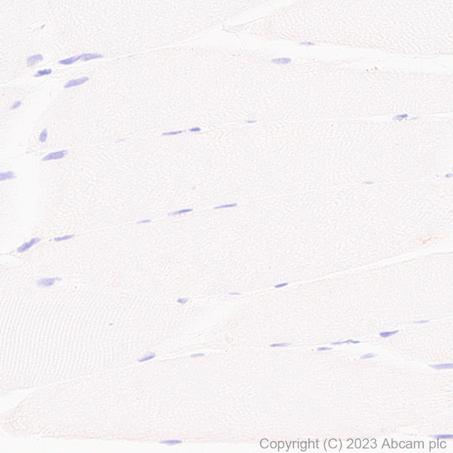 Immunohistochemistry (Formalin/PFA-fixed paraffin-embedded sections) - Anti-TRPV4 antibody [RM1062] (ab314454), expandable thumbnail