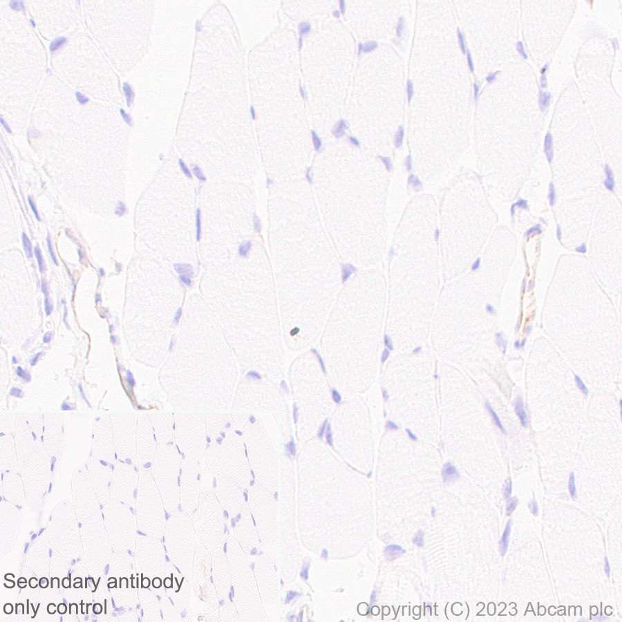 Immunohistochemistry (Formalin/PFA-fixed paraffin-embedded sections) - Anti-TRPV4 antibody [RM1062] (AB314454), expandable thumbnail