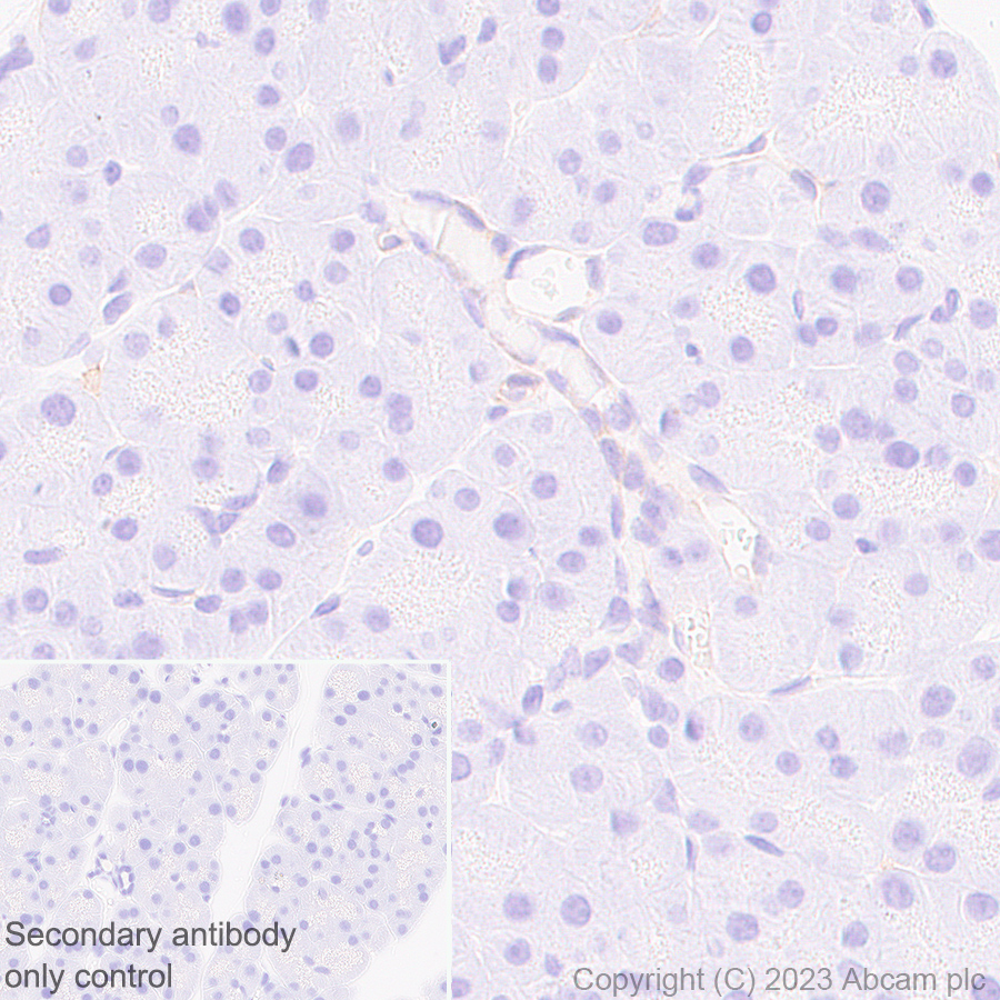 Immunohistochemistry (Formalin/PFA-fixed paraffin-embedded sections) - Anti-TRPV4 antibody [RM1062] (AB314454), expandable thumbnail