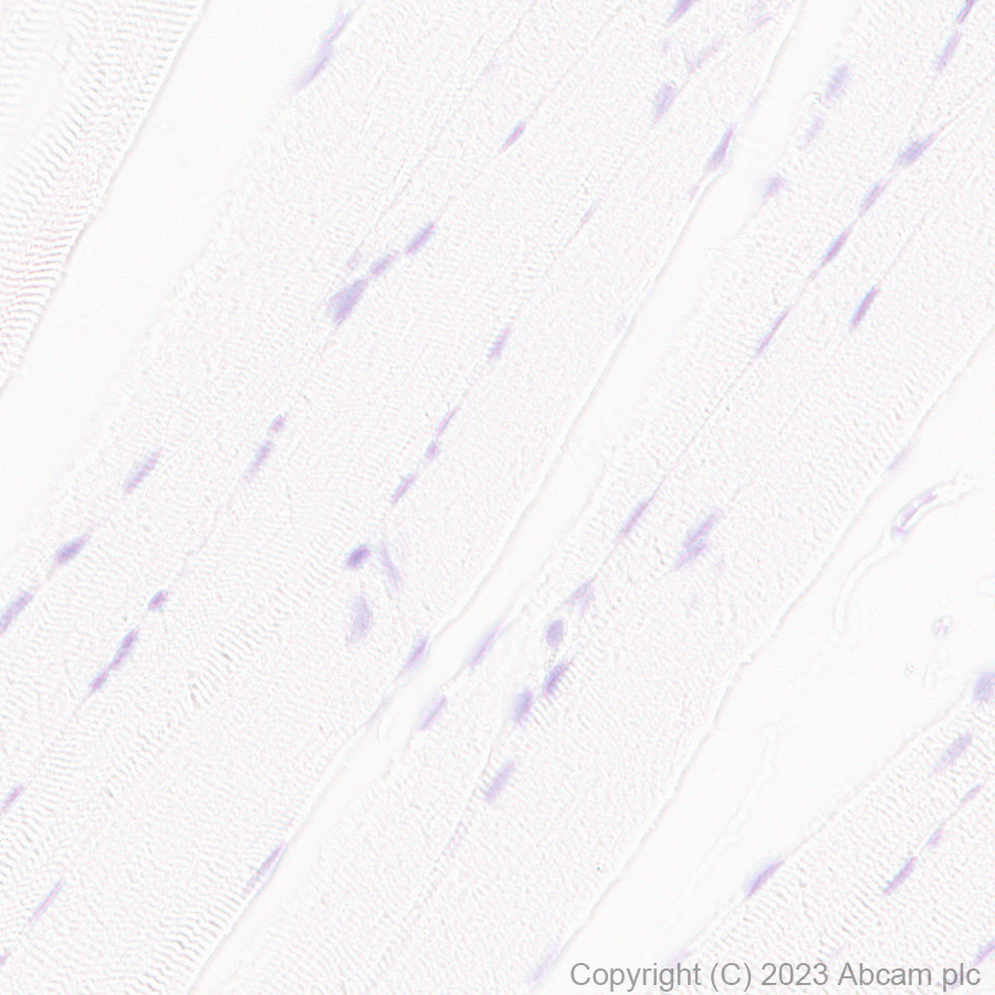 Immunohistochemistry (Formalin/PFA-fixed paraffin-embedded sections) - Anti-TRPV4 antibody [RM1062] (AB314454), expandable thumbnail