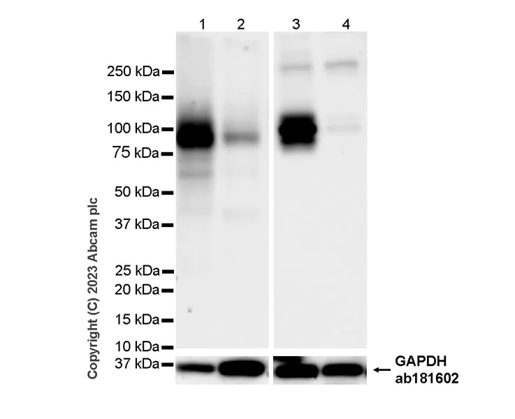 Western blot - Anti-TRPV4 antibody [RM1062] (AB314454)