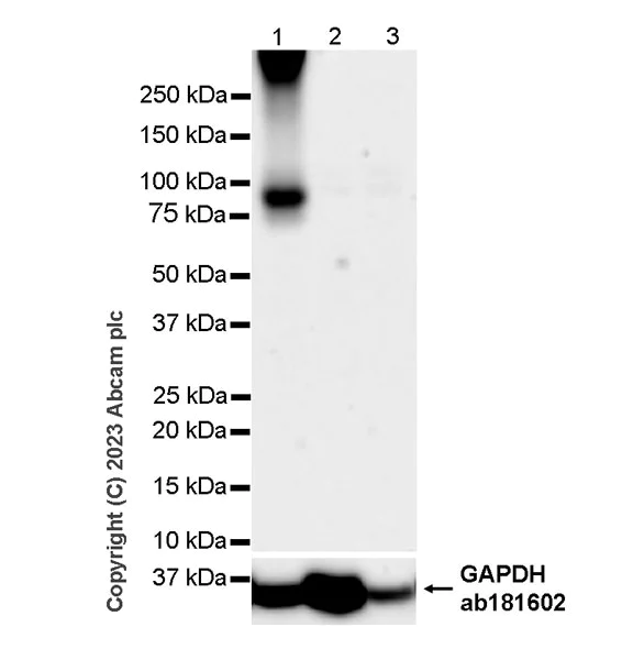 Western blot - Anti-TRPV4 antibody [RM1062] (AB314454)