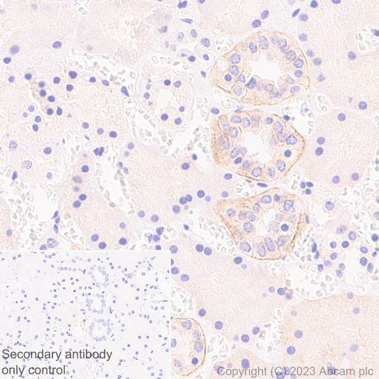 Immunohistochemistry (Formalin/PFA-fixed paraffin-embedded sections) - Anti-TRPV4 antibody [RM1062] - BSA and Azide free (AB314455)
