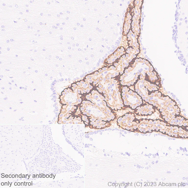 Immunohistochemistry (Formalin/PFA-fixed paraffin-embedded sections) - Anti-TRPV4 antibody [RM1062] - BSA and Azide free (AB314455)