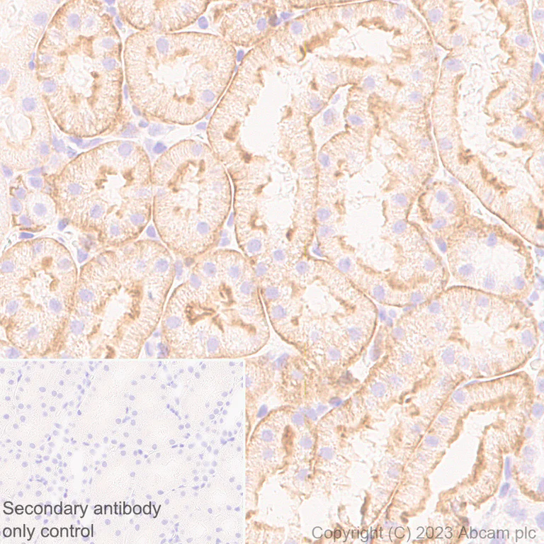 Immunohistochemistry (Formalin/PFA-fixed paraffin-embedded sections) - Anti-TRPV4 antibody [RM1062] - BSA and Azide free (AB314455)