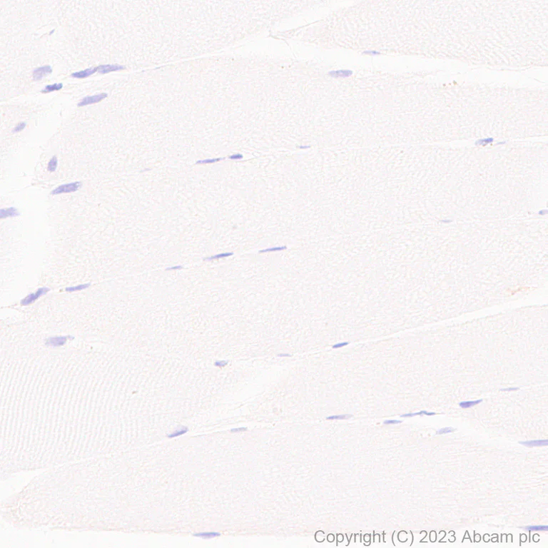 Immunohistochemistry (Formalin/PFA-fixed paraffin-embedded sections) - Anti-TRPV4 antibody [RM1062] - BSA and Azide free (AB314455)