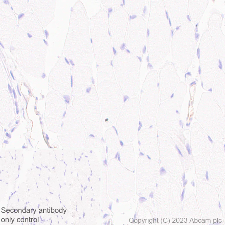 Immunohistochemistry (Formalin/PFA-fixed paraffin-embedded sections) - Anti-TRPV4 antibody [RM1062] - BSA and Azide free (AB314455)