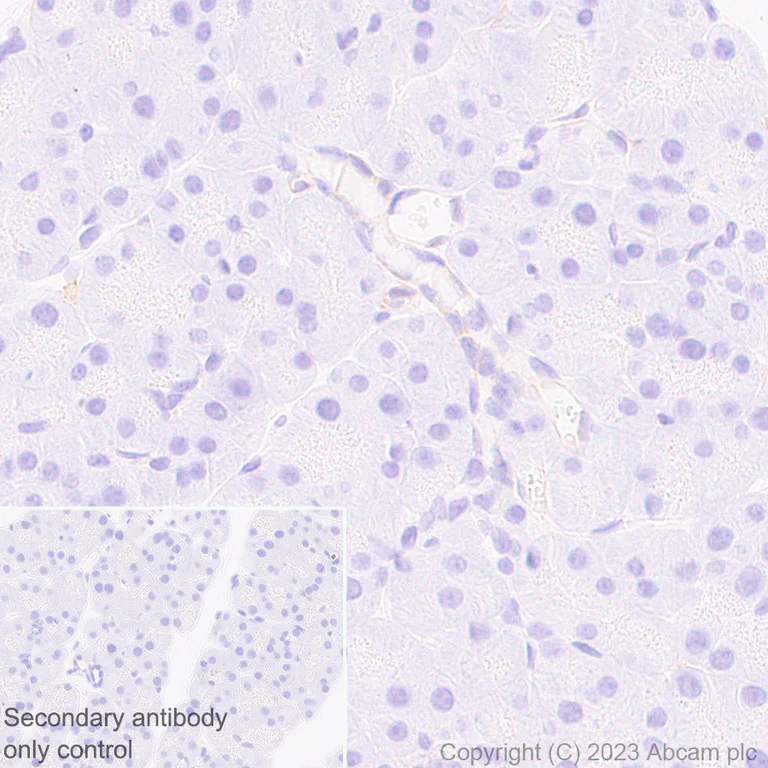 Immunohistochemistry (Formalin/PFA-fixed paraffin-embedded sections) - Anti-TRPV4 antibody [RM1062] - BSA and Azide free (AB314455)