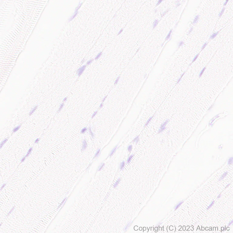Immunohistochemistry (Formalin/PFA-fixed paraffin-embedded sections) - Anti-TRPV4 antibody [RM1062] - BSA and Azide free (AB314455)