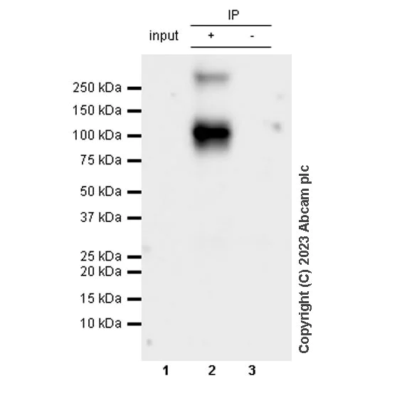 Immunoprecipitation - Anti-TRPV4 antibody [RM1062] - BSA and Azide free (AB314455)
