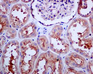 Immunohistochemistry (Formalin/PFA-fixed paraffin-embedded sections) - Anti-TRPV5 antibody [EPR8875] (AB137028)