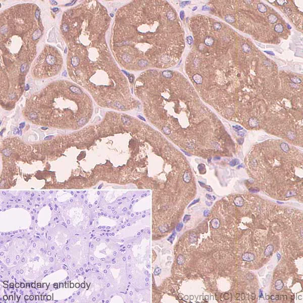 Immunohistochemistry (Formalin/PFA-fixed paraffin-embedded sections) - Anti-TRPV5 antibody [EPR8875] (AB137028)