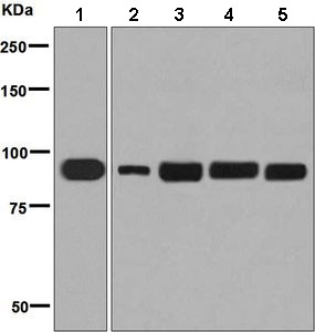 Western blot - Anti-TRPV5 antibody [EPR8875] (AB137028)