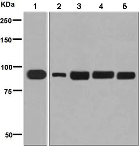 Western blot - Anti-TRPV5 antibody [EPR8875] (AB137028)