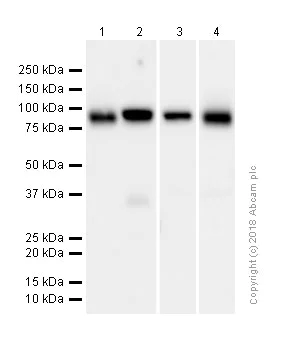 Western blot - Anti-TRPV5 antibody [EPR8875] (AB137028)