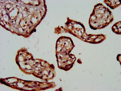 Immunohistochemistry (Formalin/PFA-fixed paraffin-embedded sections) - Anti-TRPV6 antibody (AB238107)