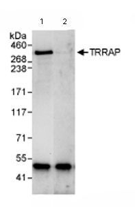 Immunoprecipitation - Anti-TRRAP antibody (AB72509)