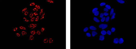Immunocytochemistry/ Immunofluorescence - Anti-TRRAP antibody [EPR14952-81] - BSA and Azide free (AB250922)