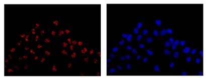 Immunocytochemistry/ Immunofluorescence - Anti-TRRAP antibody [EPR14952] (AB183517)