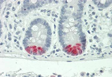 Immunohistochemistry (Formalin/PFA-fixed paraffin-embedded sections) - Anti-Trypsin antibody (AB219060)