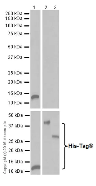 Western blot - Anti-Trypsin antibody [EPR19497] (AB200996)