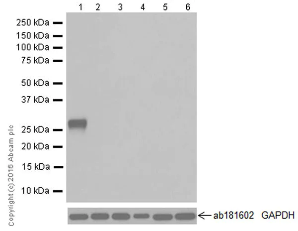 Western blot - Anti-Trypsin antibody [EPR19498-15] - BSA and Azide free (AB251527)