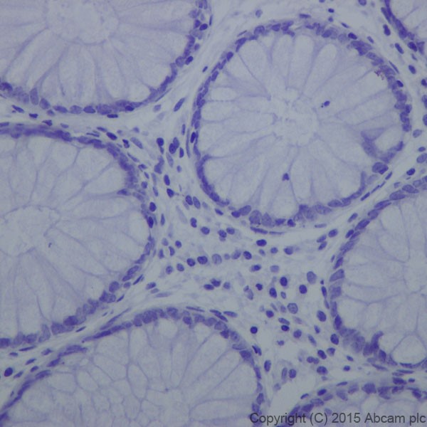 Immunohistochemistry (Formalin/PFA-fixed paraffin-embedded sections) - Anti-Trypsin antibody [EPR19498-43] (ab200997), expandable thumbnail