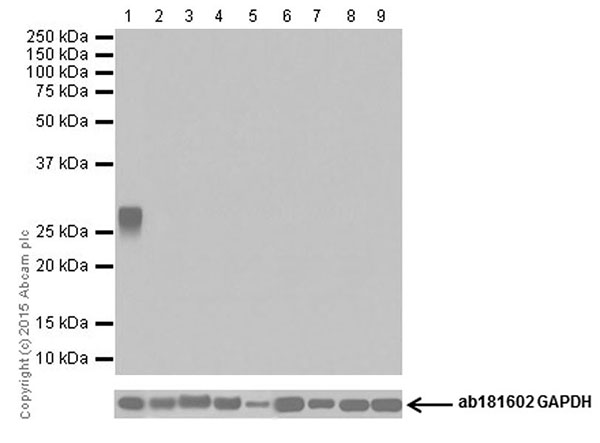 Western blot - Anti-Trypsin antibody [EPR19498-43] (AB200997), expandable thumbnail