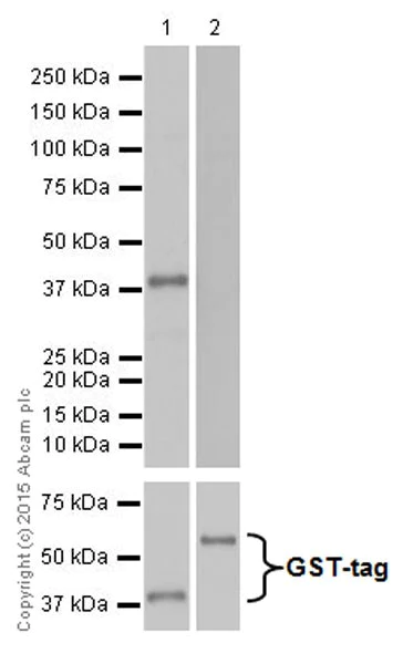 Western blot - Anti-Trypsin antibody [EPR19498-43] (AB200997)