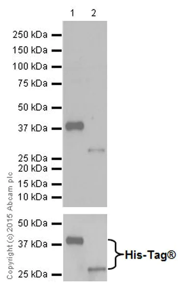 Western blot - Anti-Trypsin antibody [EPR19498-43] (AB200997)