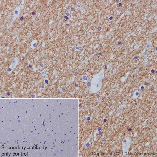 Immunohistochemistry (Formalin/PFA-fixed paraffin-embedded sections) - Anti-Trypsin antibody [EPR19498-43] - BSA and Azide free (AB251326)