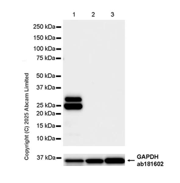 Western blot - Anti-Trypsin antibody [EPR29805-7] (AB325233)
