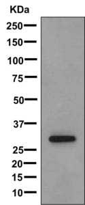 Western blot - Anti-Trypsinogen antibody [EPR11665(B)] - BSA and Azide free (AB240148), expandable thumbnail