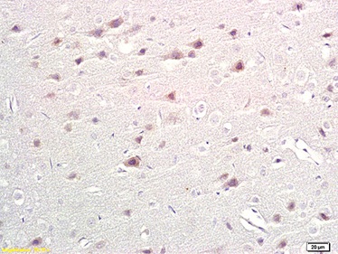 Immunohistochemistry (Formalin/PFA-fixed paraffin-embedded sections) - Anti-Tryptophan Hydroxylase/TPH antibody (AB217024)