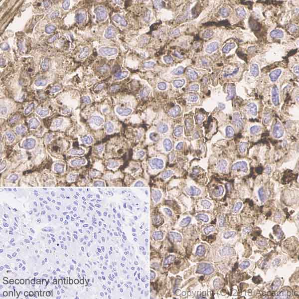 Immunohistochemistry (Formalin/PFA-fixed paraffin-embedded sections) - Anti-Tryptophan Hydroxylase/TPH antibody [EP1311Y] (AB52954), expandable thumbnail